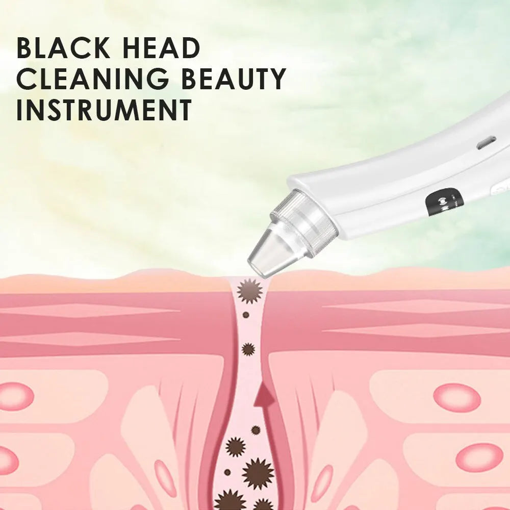 Blackhead Removal Face Vacuum